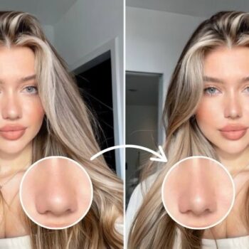 Best Nose Job Simulator Tools to Try for a New Look in 2025