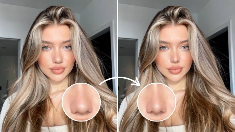 Best Nose Job Simulator Tools to Try for a New Look in 2025