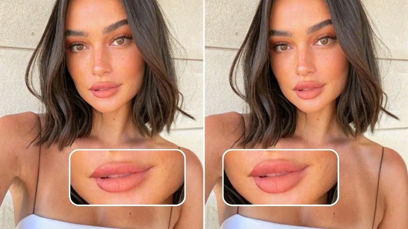 Find Out What Lip Shape Suits You? Use A Lip Filler Simulator
