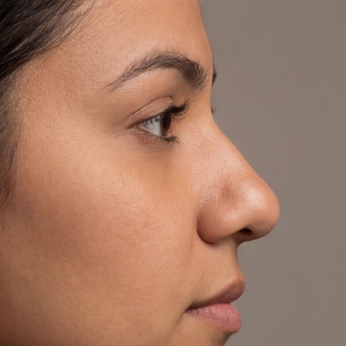 nose types - bulbous