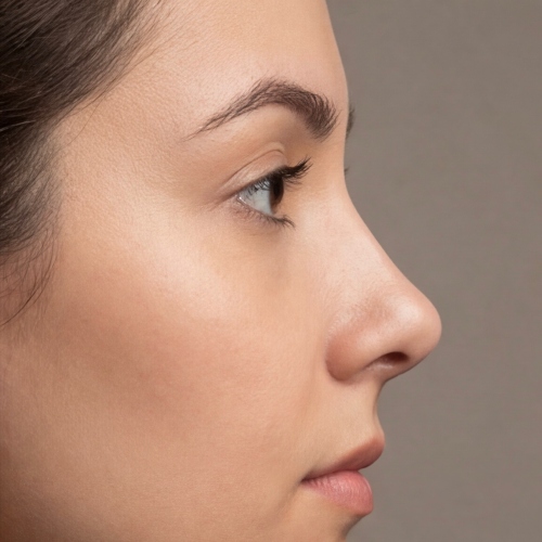 nose types - upturned